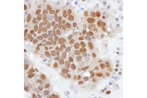 anti-Phosphate Cytidylyltransferase 1, Choline, alpha (PCYT1A) (AA 317-367) antibody