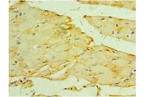 Immunohistochemistry of paraffin-embedded human skeletal muscle tissue using ABIN7160621 at dilution of 1:100 (Myotilin anticorps  (AA 443-498))