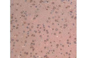 Used in DAB staining on fromalin fixed paraffin- embedded brain tissue