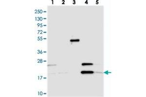 Western blot analysis of Lane 1: RT-4, Lane 2: U-251 MG, Lane 3: Human Plasma, Lane 4: Liver, Lane 5: Tonsil with C3orf75 polyclonal antibody .