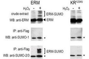 COS-7 cells were transfected for 24 hrs with a plasmid expressing FLAG-ERM (left panels) or FLAG-ERM KR12345 (right panels). (SUMO1 anticorps  (AA 55-86))