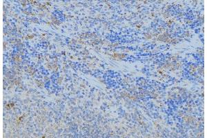 ABIN6277091 at 1/100 staining Human lymph node tissue by IHC-P. (Pyrophosphatase (Inorganic) 1 (PPA1) (Internal Region) anticorps)