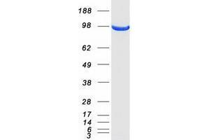 Validation with Western Blot