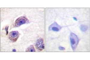 Immunohistochemistry analysis of paraffin-embedded human brain, using FAK (Phospho-Tyr407) Antibody.