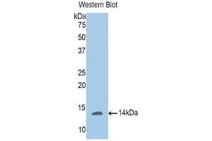 Western Blotting (WB) image for anti-Phosphoglucomutase 5 (PGM5) (AA 182-296) antibody (ABIN1176480) (Phosphoglucomutase 5 anticorps  (AA 182-296))