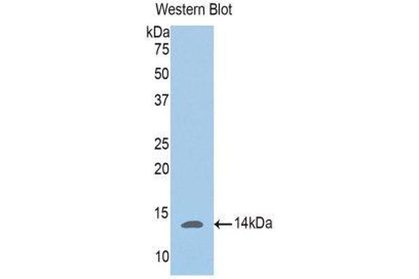 Phosphoglucomutase 5 antibody  (AA 182-296)