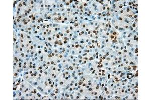 Immunohistochemical staining of paraffin-embedded Kidney tissue using anti-PRKG1 mouse monoclonal antibody. (PRKG1 anticorps)