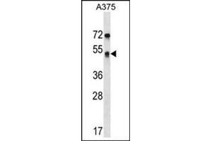 Western blot analysis of SEPT11 Antibody (Center) Cat. (Septin 11 anticorps  (Middle Region))