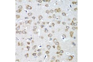 Immunohistochemistry of paraffin-embedded mouse brain using EIF1AX antibody (ABIN5973507) at dilution of 1/100 (40x lens). (EIF1AX anticorps)