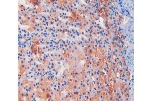 IHC-P analysis of adrenal gland tissue, with DAB staining.