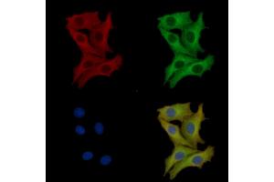 ABIN7093775 and ABIN7097816 staining HepG2 cells by IF/ICC.