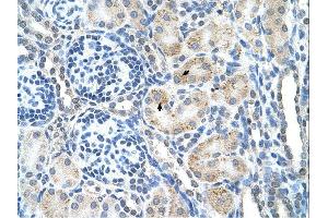 SPPL2B antibody was used for immunohistochemistry at a concentration of 4-8 ug/ml. (SPPL2B anticorps  (N-Term))