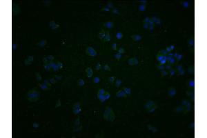 Immunofluorescence staining of PC3 cells with ABIN7163924 at 1:200, counter-stained with DAPI. (KCNK15 anticorps  (AA 244-330))