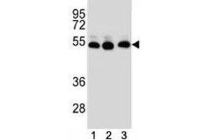 TUBB2B antibody western blot analysis of (1) HepG2, (2) HeLa, (3) MDA-MB231 lysate (TUBB2B anticorps  (AA 12-39))