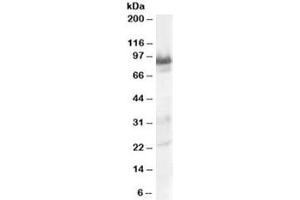 Western blot testing of human heart lysate with TRAK1 antibody at 0. (TRAK1 anticorps)