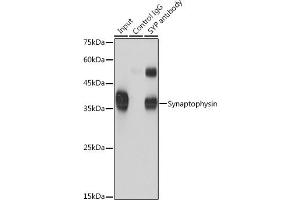 Immunoprecipitation analysis of 600 μg extracts of Mouse brain cells using 3 μg Synaptophysin antibody (ABIN6135349, ABIN6148783, ABIN6148784 and ABIN6221958). (Synaptophysin anticorps  (AA 150-250))