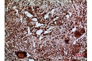 Immunohistochemistry (IHC) analysis of paraffin-embedded Human Lung, antibody was diluted at 1:100. (LAMC2 anticorps  (C-Term))