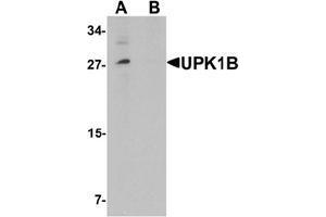 Western blot analysis of UPK1B in mouse bladder tissue lysate with UPK1B Antibody  at (A) 0. (Uroplakin 1B anticorps  (Middle Region))