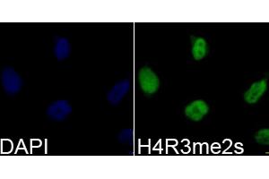 Immunofluorescence analysis of 293T cells using Symmetric DiMethyl-Histone H4-R3 antibody (ABIN3017488, ABIN3017489, ABIN3017490, ABIN1680265 and ABIN6220116). (Histone H4 anticorps  (2meArg3))