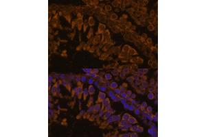 Immunofluorescence analysis of rat testis using ZPBP antibody (ABIN7271569) at dilution of 1:100.