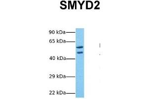 Host:  Rabbit  Target Name:  SMYD2  Sample Tissue:  Human 293T  Antibody Dilution:  1. (SMYD2A anticorps  (Middle Region))