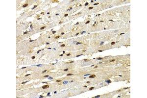 Immunohistochemistry of paraffin-embedded Rat heart using IRF2 Polyclonal Antibody at dilution of 1:200 (40x lens). (IRF2 anticorps)