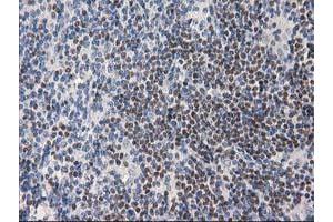 Image no. 6 for anti-Ankyrin Repeat Domain 53 (ANKRD53) (AA 1-300) antibody (ABIN1490720) (ANKRD53 anticorps  (AA 1-300))