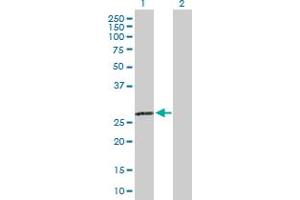 Western Blot analysis of C1QA expression in transfected 293T cell line by C1QA MaxPab polyclonal antibody. (C1QA anticorps  (AA 1-245))