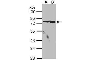 WB Image Sample(30 μg of whole cell lysate) A:A431, B:H1299 10% SDS PAGE antibody diluted at 1:1500
