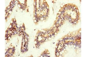 Immunohistochemistry of paraffin-embedded human small intestine tissue using ABIN7154692 at dilution of 1:100