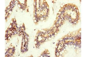 Immunohistochemistry of paraffin-embedded human small intestine tissue using ABIN7154692 at dilution of 1:100 (GNB2 anticorps  (AA 1-340))