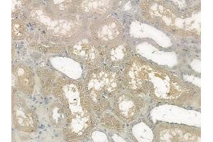 ABIN6256465 and ABIN6267170 at 1/100 staining human normal kidney tissue by IHC-P. (RICTOR anticorps  (pThr1135))