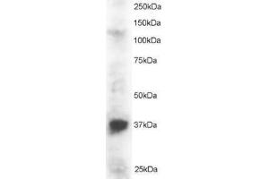 Image no. 1 for anti-PIN2/TERF1 Interacting, Telomerase Inhibitor 1 (PINX1) (AA 2-15) antibody (ABIN297473) (PINX1 anticorps  (AA 2-15))