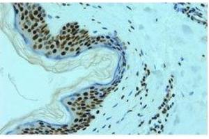 Image no. 3 for anti-Heterogeneous Nuclear Ribonucleoprotein L (HNRNPL) antibody (ABIN108588)