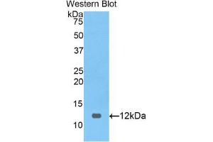 Western blot analysis of the recombinant protein. (PRAME anticorps  (AA 416-502))