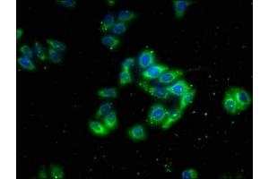 Immunofluorescence staining of HepG2 cells with ABIN7175582 at 1:133, counter-stained with DAPI.