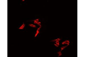 ABIN6278120 staining HepG2? (TRIM29 anticorps  (Internal Region))