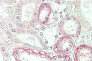 Formalin-fixed and paraffin-embedded H.