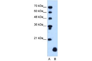 PLP2 antibody used at 1. (PLP2 anticorps)