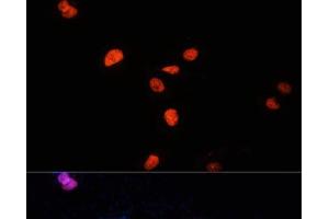 Immunofluorescence analysis of U-2 OS cells using KDM3A Polyclonal Antibody at dilution of 1:100 (40x lens). (KDM3A anticorps)