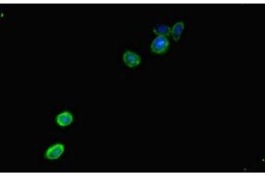 Immunofluorescent analysis of HepG2 cells using ABIN7146491 at dilution of 1:100 and Alexa Fluor 488-congugated AffiniPure Goat Anti-Rabbit IgG(H+L) (CAMTA1 anticorps  (AA 201-452))