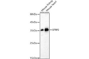 Western blot analysis of extracts of various cell lines, using SFRP2 antibody (ABIN6131355, ABIN6147675, ABIN6147677 and ABIN6221030) at 1:1000 dilution. (SFRP2 anticorps  (AA 25-295))