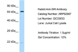 Western Blotting (WB) image for anti-Sorcin (SRI) (C-Term) antibody (ABIN2789324) (SRI anticorps  (C-Term))