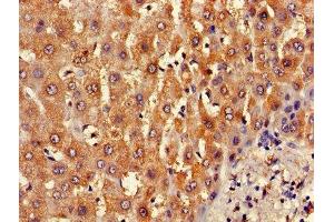 Immunohistochemistry of paraffin-embedded human liver tissue using ABIN7145367 at dilution of 1:100 (B3GALT2 anticorps  (AA 201-422))