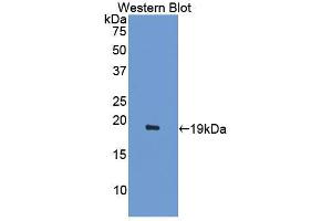Western blot analysis of the recombinant protein. (ACVR2A anticorps  (AA 20-95))
