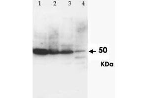 Western Blot analysis of CCR6 expression from cell and tissue extracts with CCR6 polyclonal antibody . (CCR6 anticorps  (N-Term))