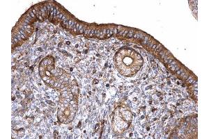 IHC-P Image T-Plastin antibody detects T-Plastin protein at cytoplasm on mouse cervix by immunohistochemical analysis. (Plastin 3 anticorps)