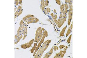 Immunohistochemistry of paraffin-embedded rat heart using MYO10 antibody (ABIN5974593) (40x lens).