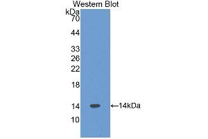Western blot analysis of the recombinant protein. (VPREB1 anticorps  (AA 43-128))