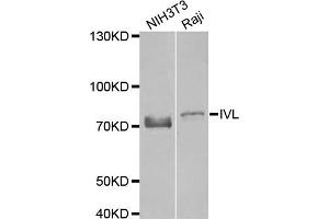 Western blot analysis of extracts of NIH3T3 and Raji cell lines, using IVL antibody. (Involucrin anticorps)